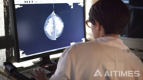 구글 헬스가 지난 1일 X선 유방촬영술로 사람 의사보다 정확히 유방암 진단을 내리는 AI 시스템을 개발했다. (사진=Getty Images). ©AI타임스