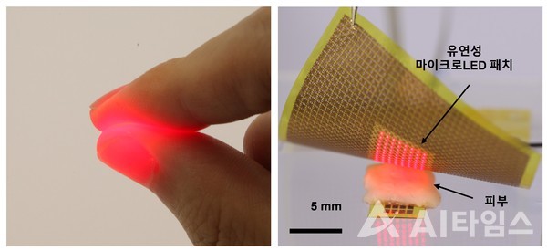 생체 조직(손가락)을 통과하는 마이크로LED의 적색광 사진(좌측)과 유연성 마이크로LED 패치에서 피부를 통해 빛을 조사하는 사진(우측). (사진=GIST 제공).