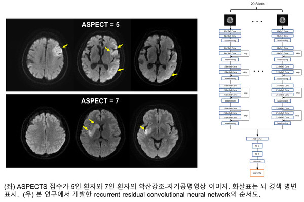201019 AI기반 뇌종중 MRI평가시스템 개발(사진3) (1)