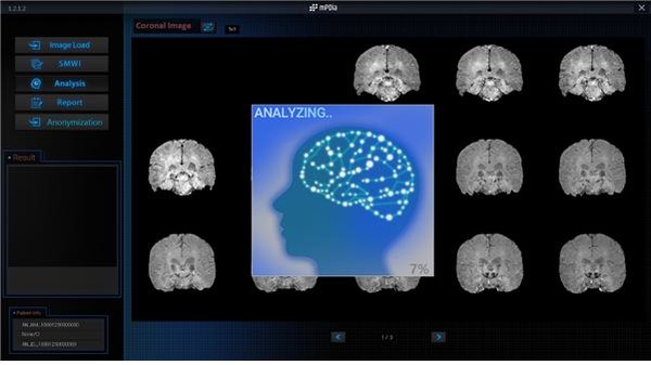 휴런 mPDia SW 화면
