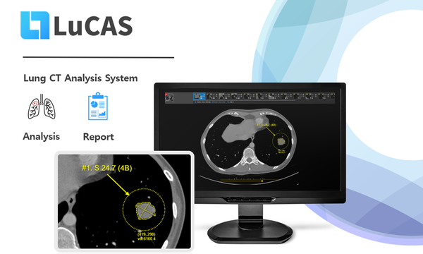 모니터코퍼레이션의 흉부CT 기반 AI 진단 솔루션 루카스(LuCAS).