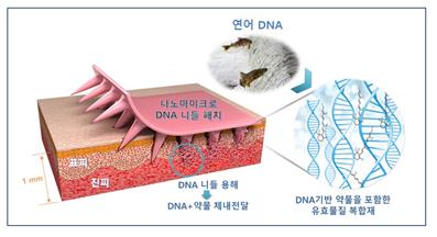 기계연이 개발한 ‘나노마이크로 DNA 니들패치’(사진=기계연)