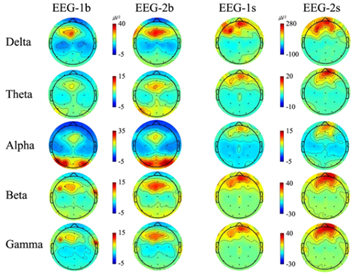 EEG-1b(실험 1회차, 사이버 멀미 실험 전), EEG-2b(실험 2회차, 사이버 멀미 실험 전), EEG-1s(실험 1회차, 사이버 멀미 실험 후), EEG-2s(실험 2회차, 사이버 멀미 실험 후) (사진=한국표준과학연구원)