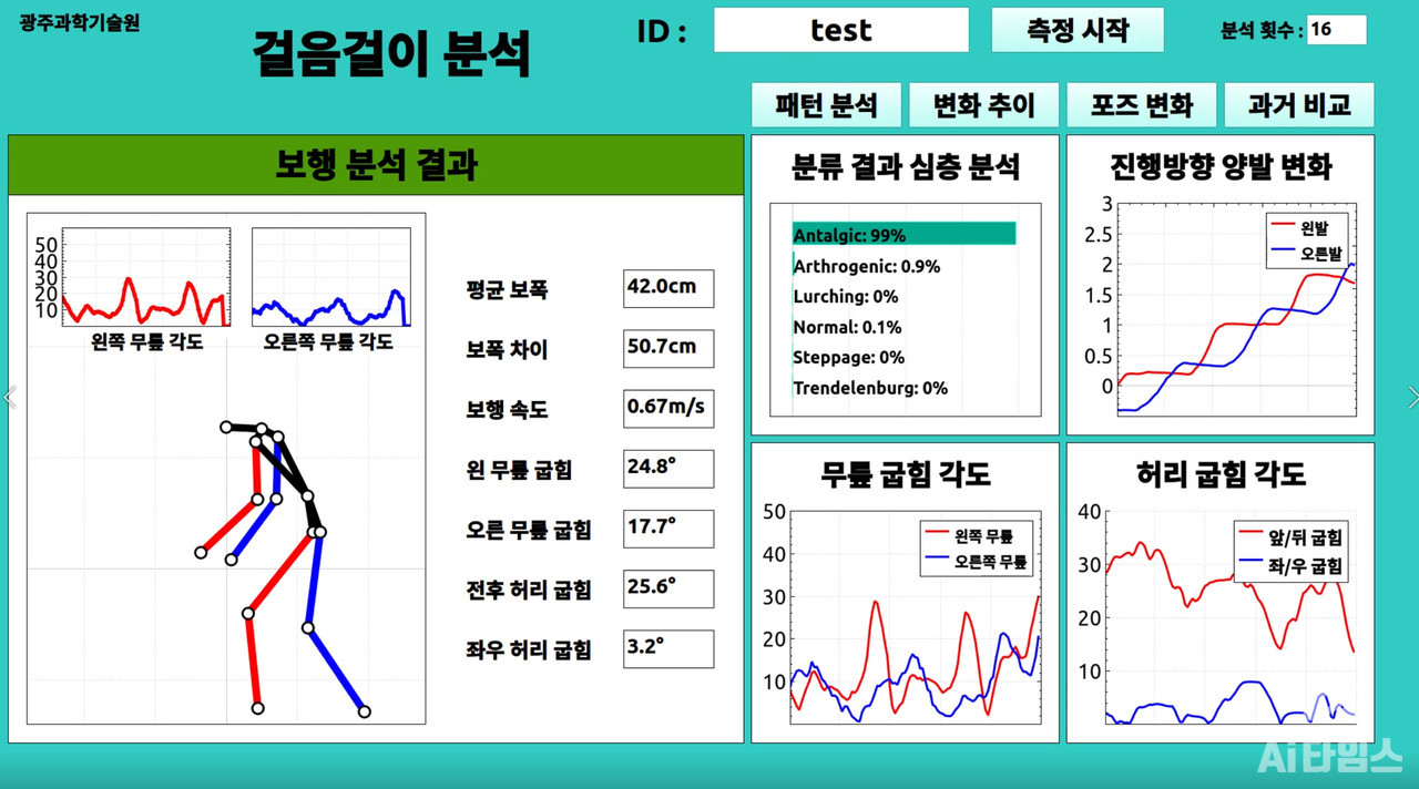 AI 기반 보행 분석 시스템의 보행 분석 결과. (사진=지스트 제공).