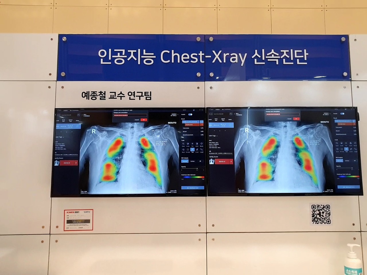 예종철 교수 연구팀이 개발한 AI 흉부 엑스레이 솔루션(사진=박성은 기자)