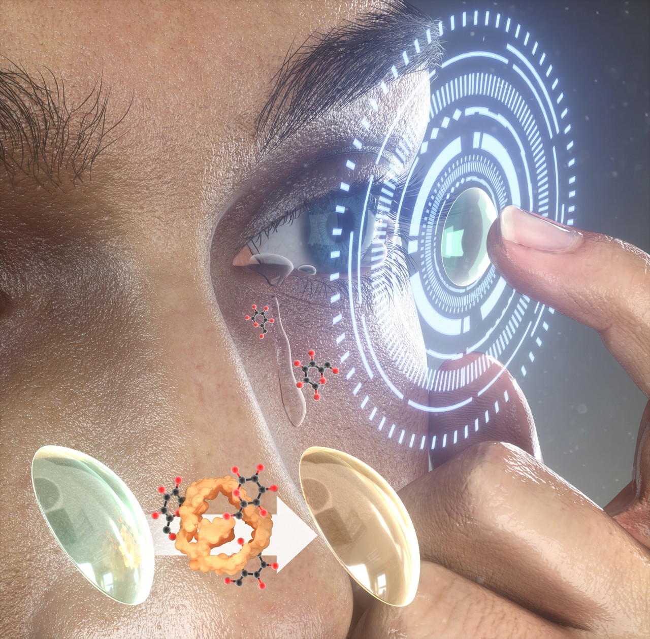 광주과학기술원(지스트‧GIST) 의생명공학과 정의헌 교수팀은 한양대학교 생명공학과 이동윤 교수(일릭사 파마텍)팀과 공동연구를 진행해 스마트 콘택트렌즈를 이용한 비침습적 당뇨병 자가 진단 시스템을 개발했다. 안구 착용 후 스마트 콘택트렌즈의 눈물 속 포도당에 의한 발색 변화 모식도. (사진=지스트 제공).