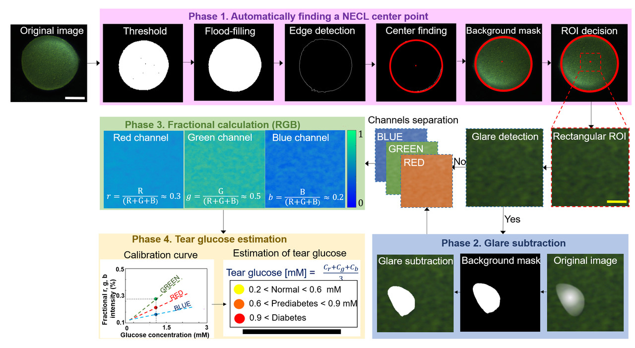 스마트 콘택트렌즈의 자동 추적과 발색 변화를 정량적으로 분석할 수 있는 알고리즘 구성도. (사진=지스트 제공).