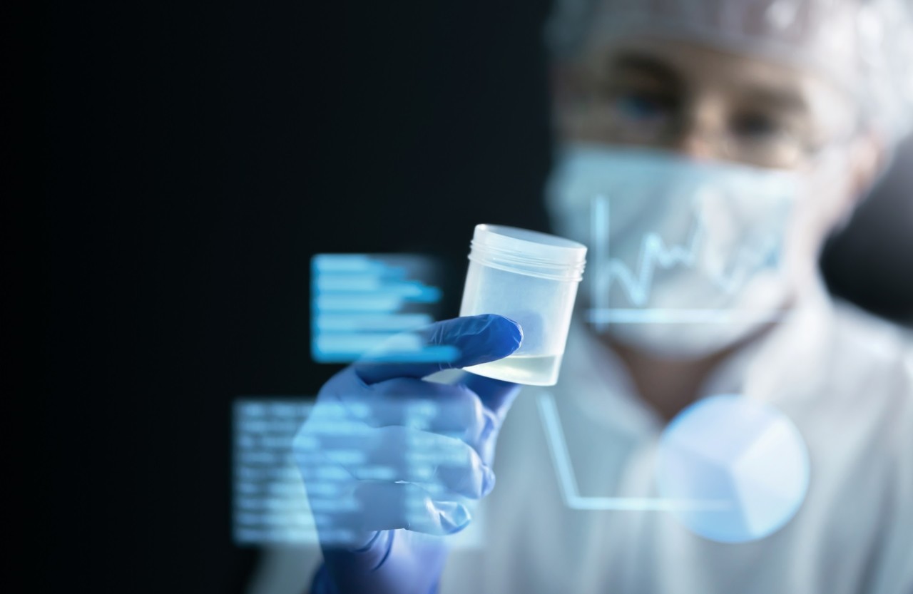 몸속 질병 여부를 손쉽게 확인하고 예측할 수 있는 소변검사가 AI 기술로 인해 스마트해지고 정확성이 높아지고 있다. (사진=셔터스톡).