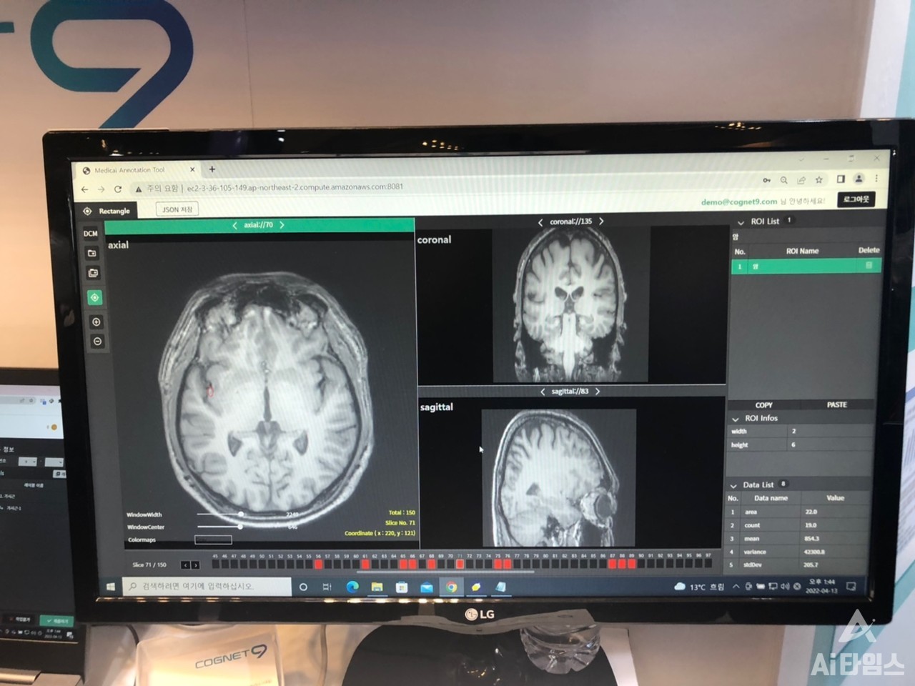 코그넷나인은 뇌 CT 영상을 AI가 분석해 질환을 찾는 레퍼런스를 보유하고 있다. (사진=김동원 기자)
