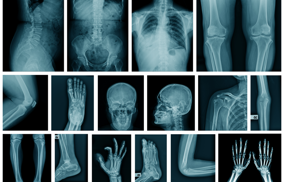 MIT와 하버드의 연구에 따르면 X선과 CT 스캔을 읽도록 훈련된 인공 지능 프로그램은 90%의 정확도로 사람의 인종을 예측할 수 있다.(사진=셔터스톡)