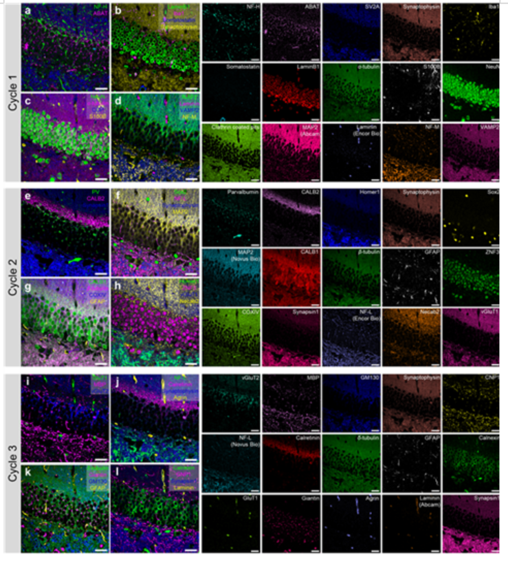 카이스트는 기존보다 5배 이상 더 많은 단백질 바이오마커를 탐지할 수 있는 기술을 내놨다. (사진=카이스트)