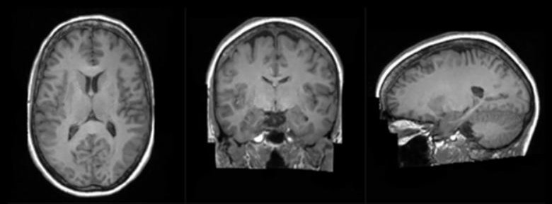 AI와 켐브리지-1 슈퍼컴퓨터를 사용해 생성한 합성 뇌 3D 이미지.(사진=킹스 칼리지 런던)