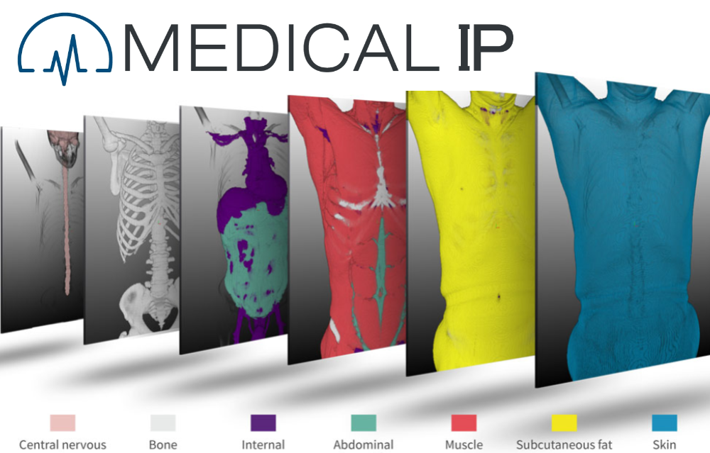 조달청이 메디컬아이피(MEDICAL IP)가 개발한 체성분 자동분석 솔루션 ‘딥캐치(DeepCatch)’를 혁신제품으로 지정했다. (사진=메디컬아이피/편집=김미정 기자)