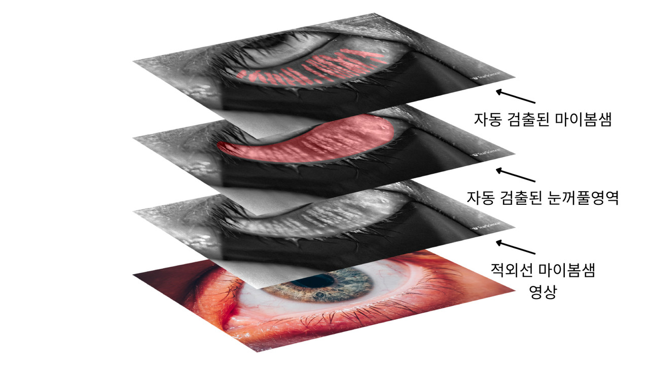 온라인에 공개된 인공지능(AI) 기반 눈꺼풀 마이봄샘 원본 및 분석데이터 개략도. 연구팀은 연구에 사용된 마이봄샘 원본 영상과 각종 분석데이터를 온라인상에 공개해 관련 연구자들이 새로운 AI 기술을 시도하고 결과를 검증할 수 있도록 제공했다. (사진=지스트 제공).