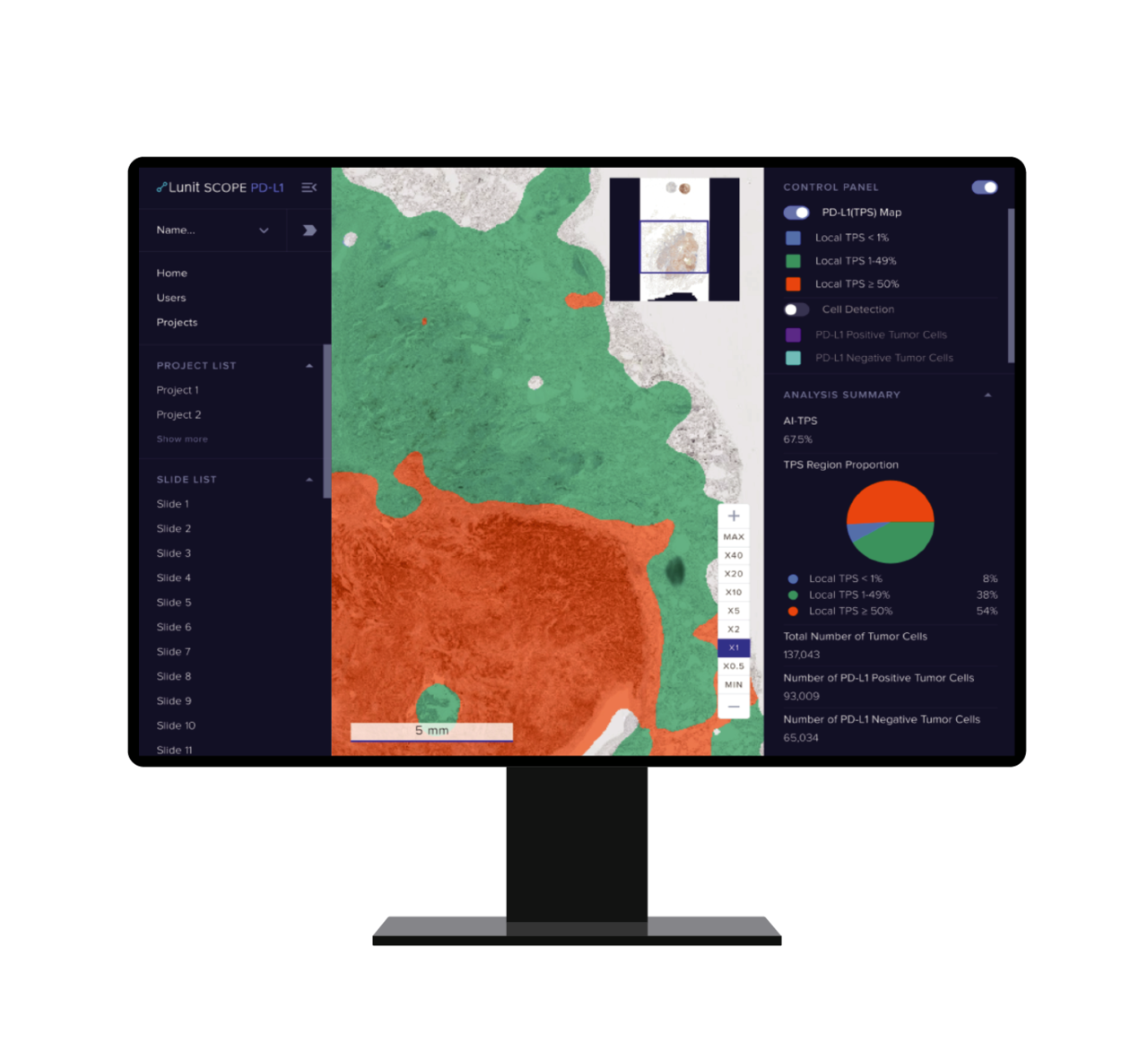 AI 병리 분석 솔루션 ‘루닛 스코프 PD-L1 TPS' (사진=루닛)