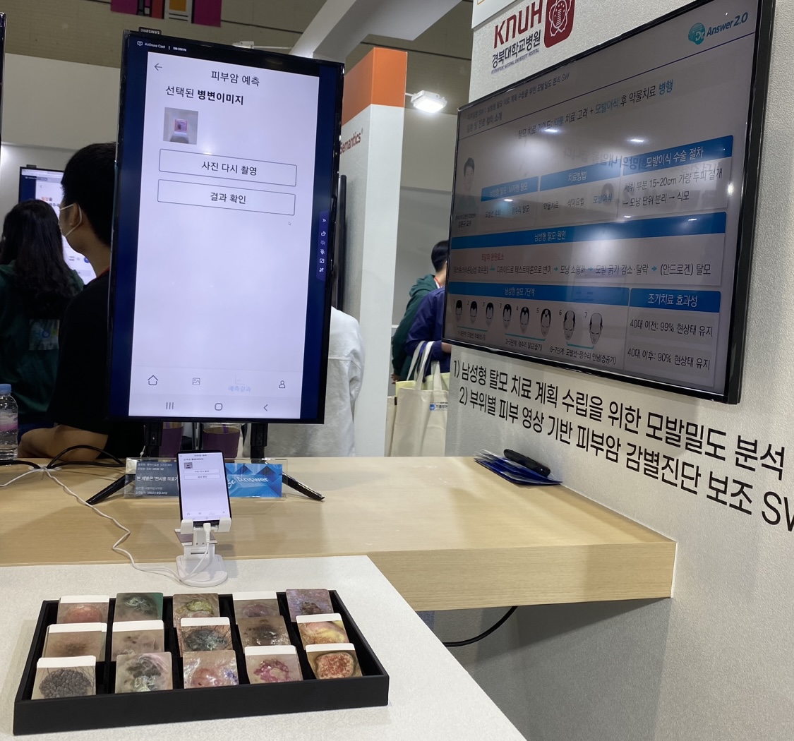 라이스시맨틱스와 경북대가 개발 중인 피부암 예측 솔루션 