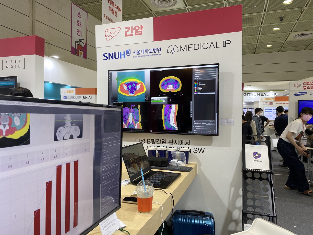 메디컬아이피가 간암을 미리 예측하는 솔루션 '딥캐치 리버'를 선보이고 있다. 
