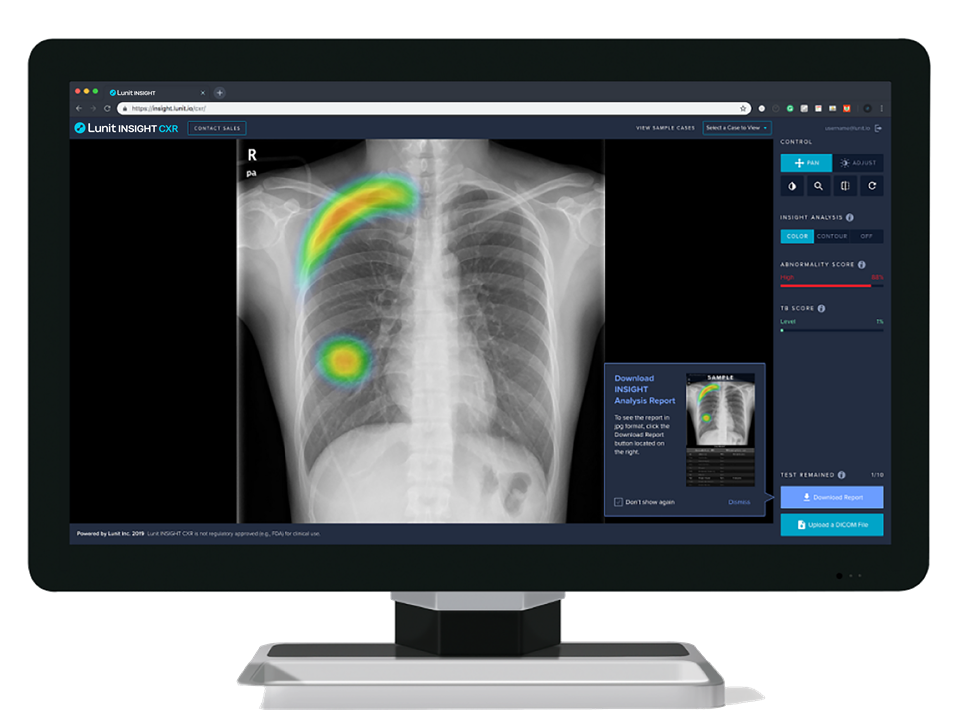 루닛 인사이트 CXR 데모 이미지 (사진=루닛)