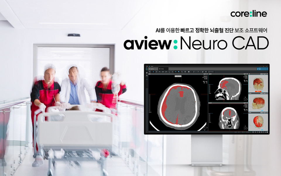 에이뷰 뉴로 캐드 이미지 (사진=코어라인소프트)