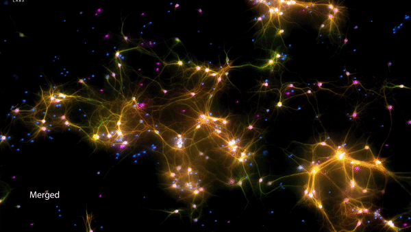 Marcas verdes são neurônios e axônios, marcas roxas são neurônios, marcas vermelhas são dendritos e marcas azuis são todas células.  (foto = laboratório cortical)