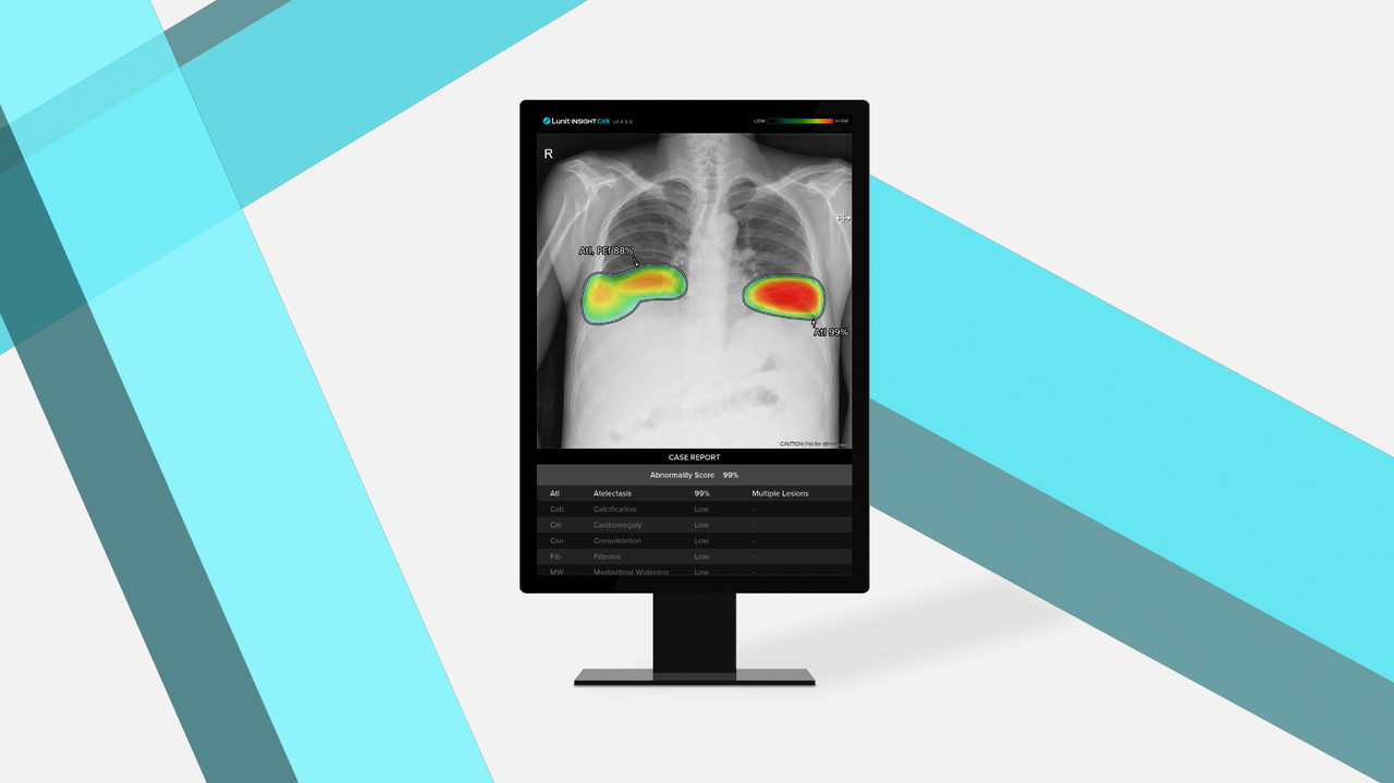 루닛 흉부 엑스레이 AI 영상분석 솔루션 '루닛 인사이트 CXR' (사진=루닛)