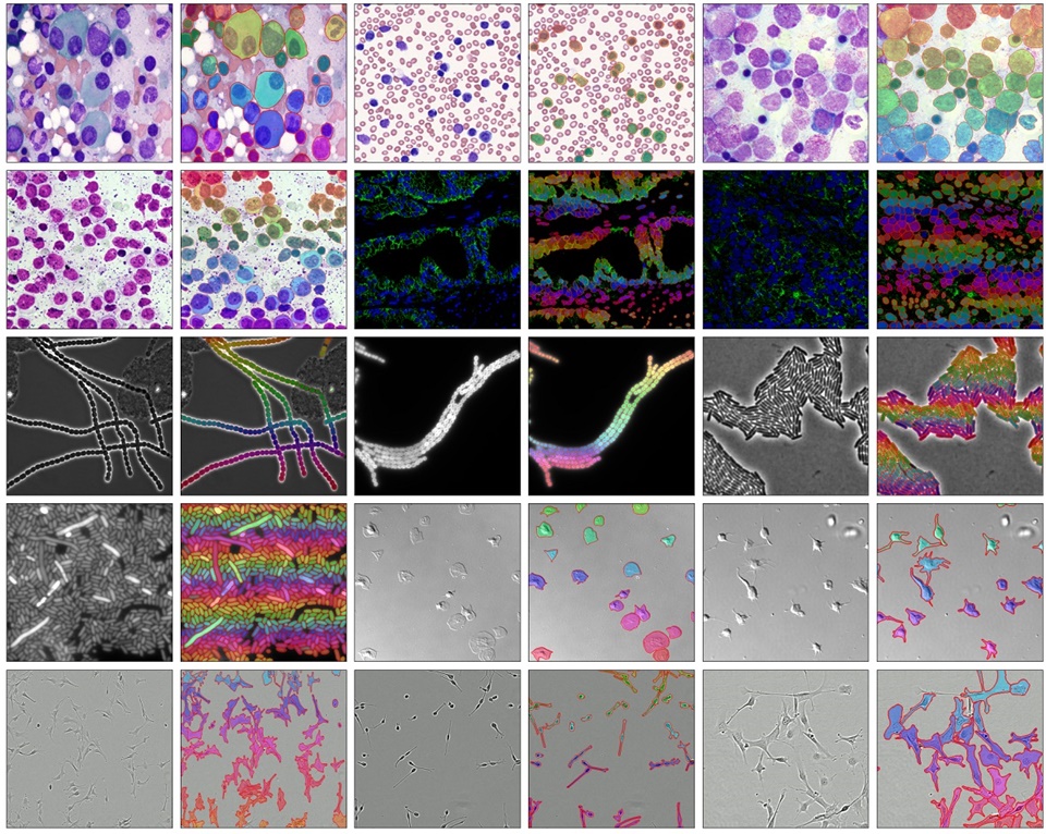 메디아 기술로 세포를 인식한 예시 (사진=KAIST)