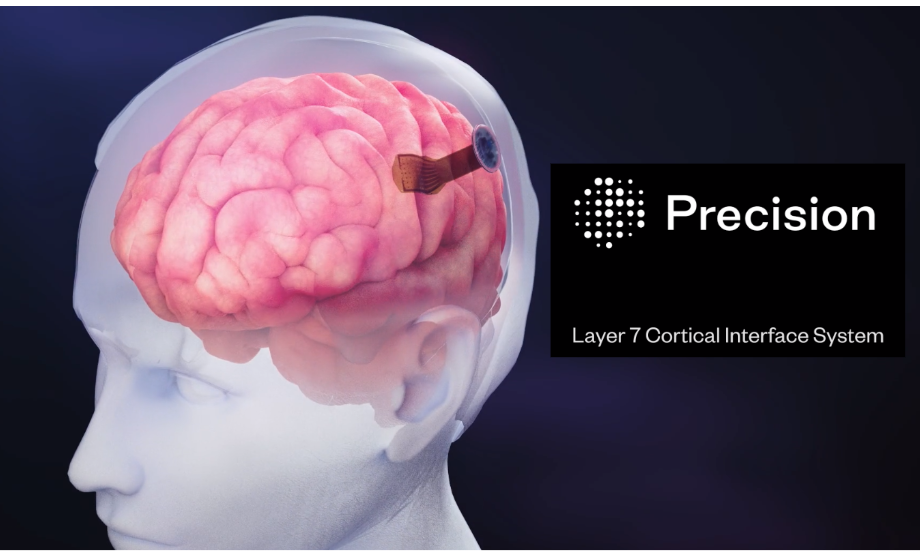 레이어 7 코티컬 인터페이스 (사진=프리시즌 뉴로사이언스)