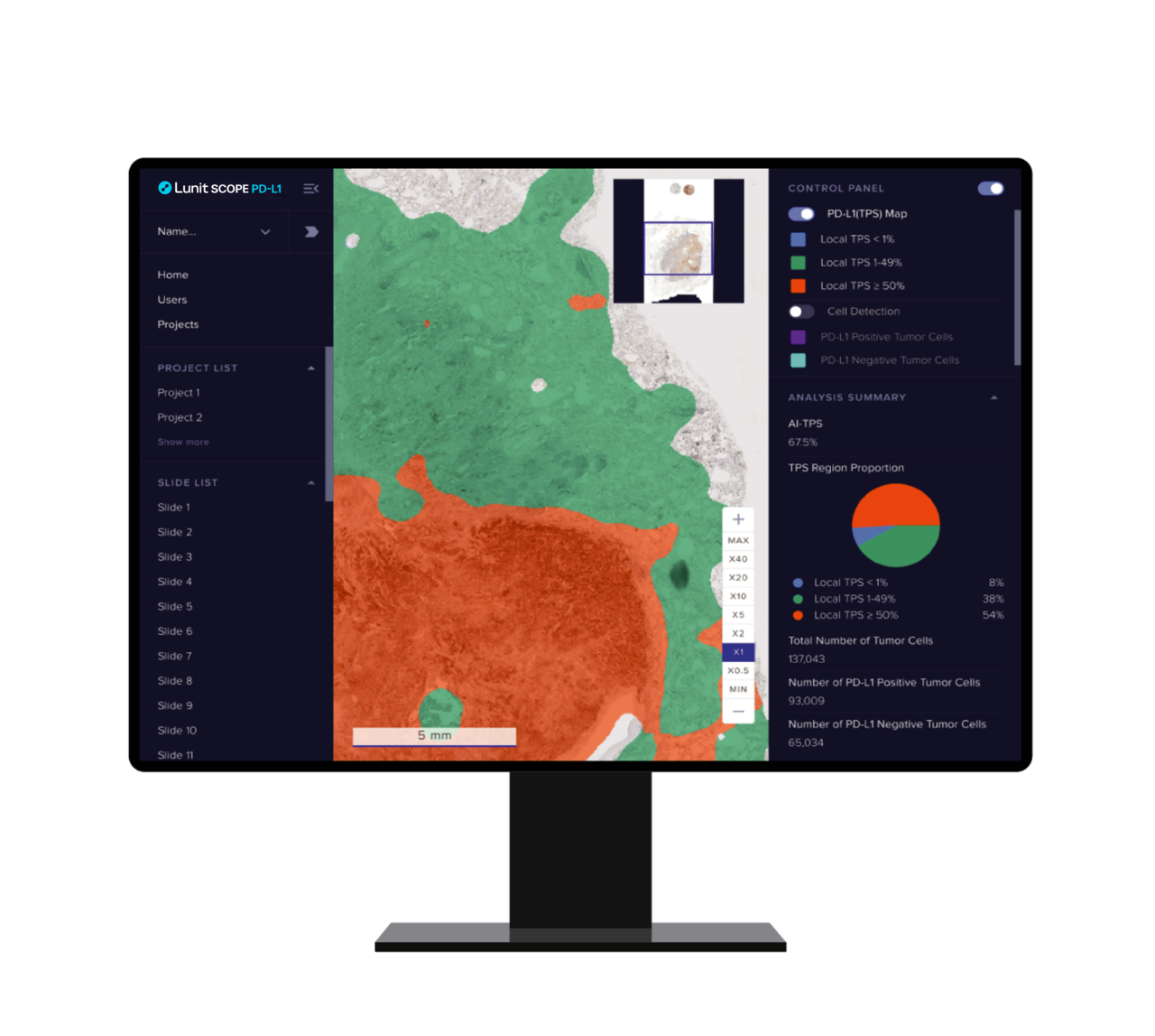 '루닛 스코프 PD-L1' 사용 화면 (사진=루닛) 