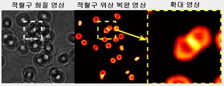 적혈구 복원 영상 (사진=KAIST)