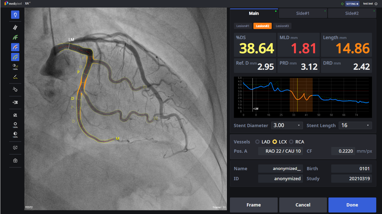 (사진=메디픽셀)