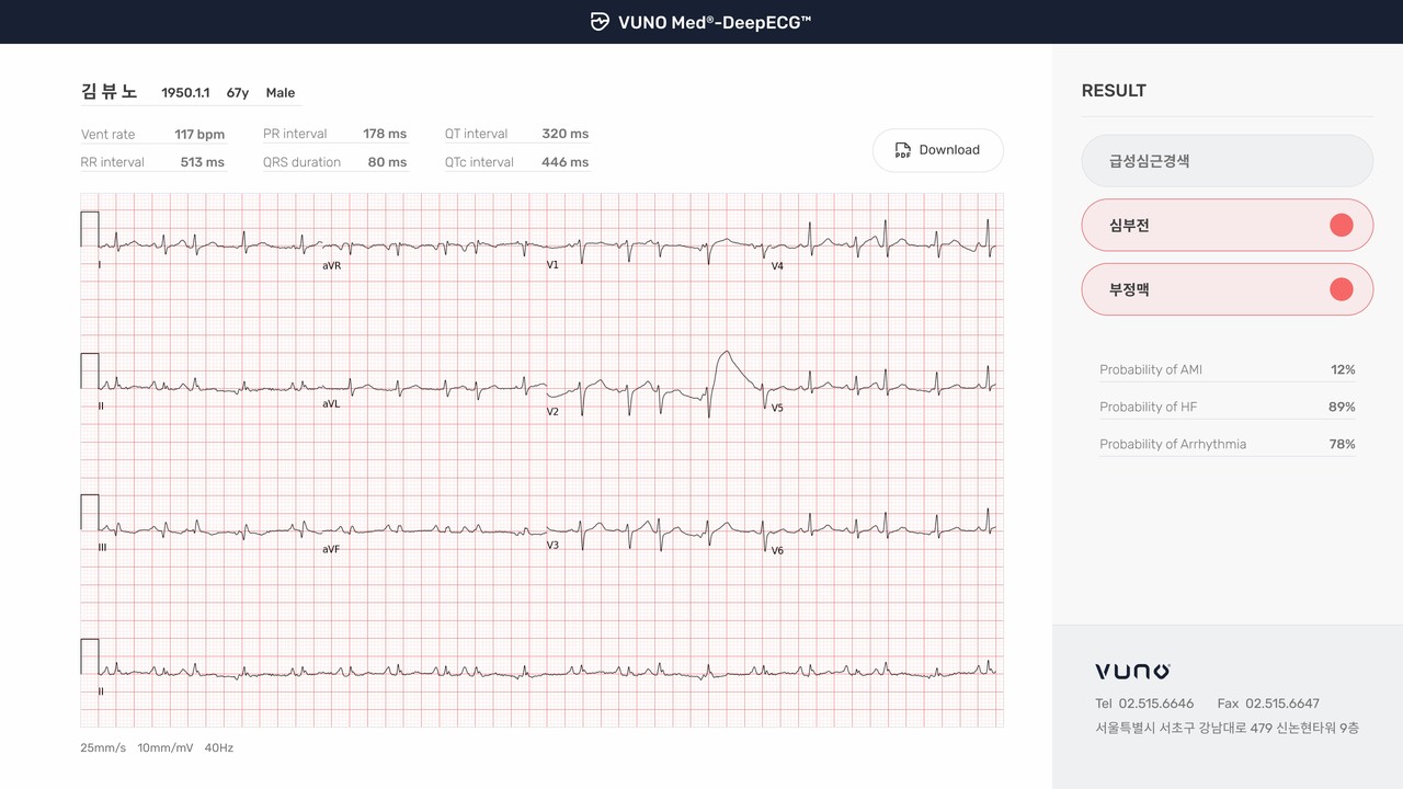 뷰노메드 딥ECG 운영화면 예시 (사진=뷰노)