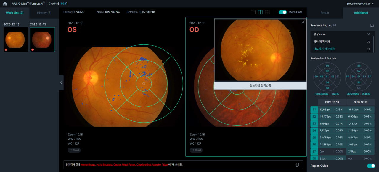 뷰노메드 펀더스AI 운영화면 예시 (사진=뷰노)