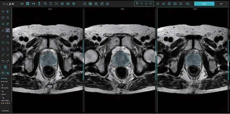 메디허브 프로스테이트 예시 이미지 (사진=제이엘케이)