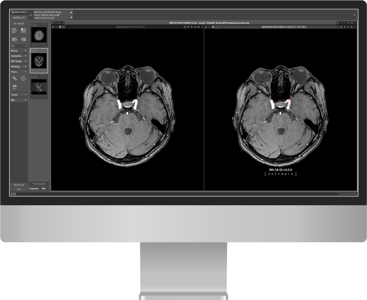 딥뉴로 예시 이미지 (사진=딥노이드)