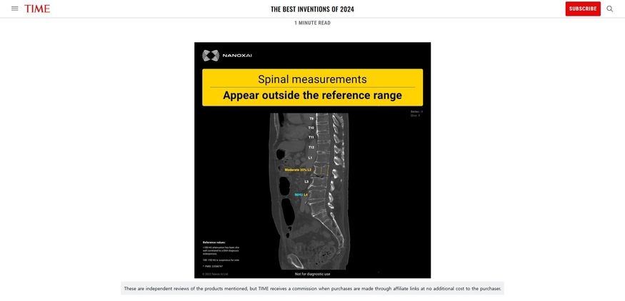 타임지 선정 2024 올해의 발명품에 소개된 나녹스AI의 영상 분석 솔루션. (사진=타임지 홈페이지)