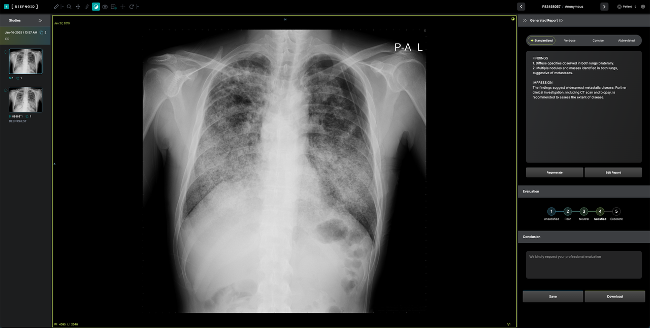 딥젠 적용 의료AI 서비스 예시 (사진=딥노이드)