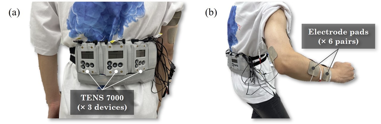 텔레펄스 EMS 장치 구성(사진=GIST)