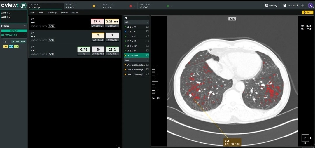 (사진=코어라인소프트)