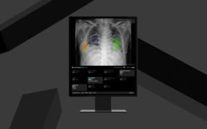 루닛, AI 흉부 엑스레이 진단 솔루션 '루닛 인사이트 CXR4' CE MDR 인증 획득 및 유럽 시장 확대 계획
